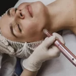 ¿Qué es el Accent Facial y por qué es uno de los tratamientos más efectivos para rejuvenecer tu piel?