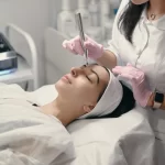 Microdermoabrasión: beneficios para piel grasa, con acné o signos de la edad